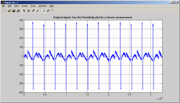 Read Raw signal plot